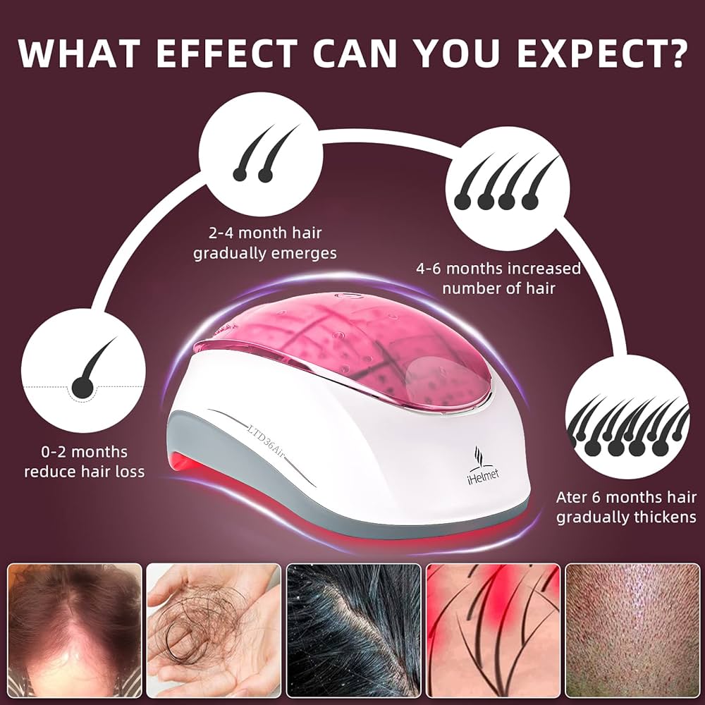 iHelmet Hair Growth System