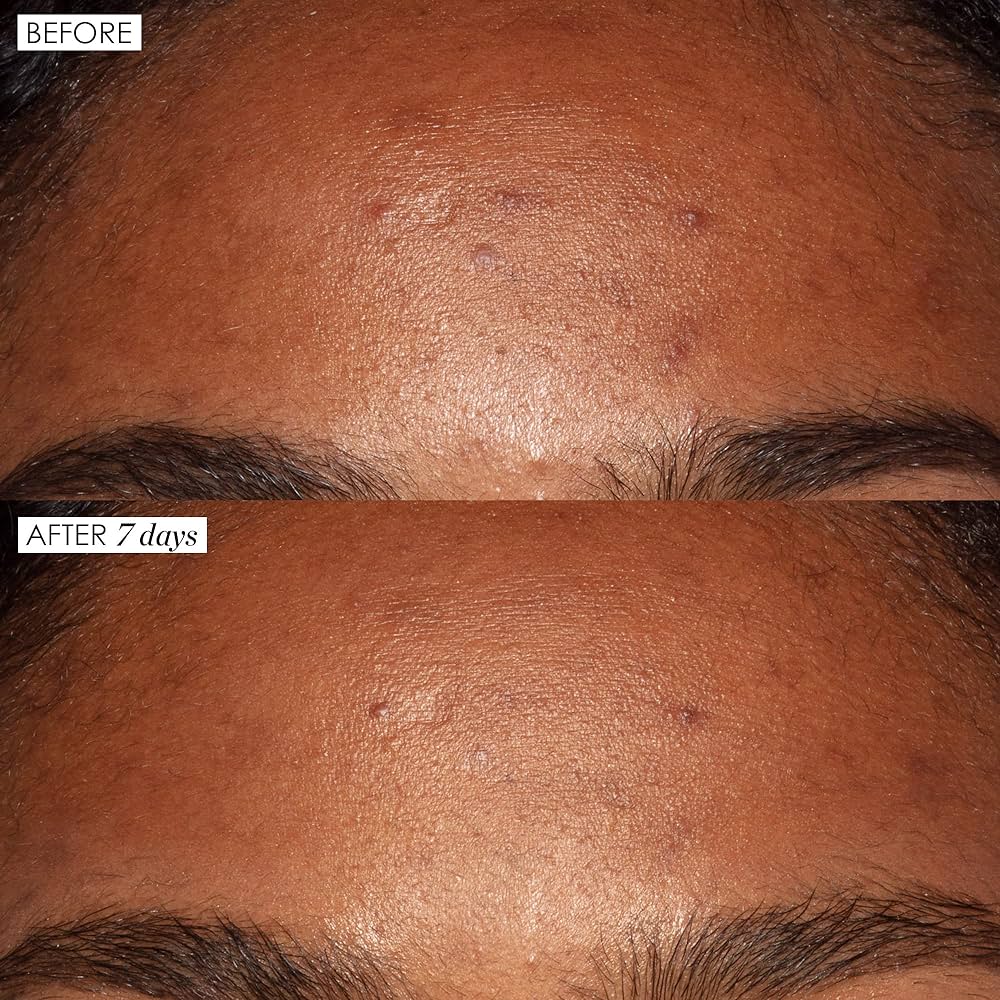 Sunday Riley Good Genes All-In-One Lactic Acid Treatment
